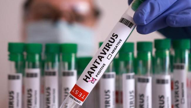 Muncul Isu Hantavirus Bermula dari Israel, Benarkah? – Publik Pos Update