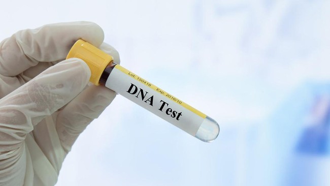 Tak Sengaja Tes DNA Bongkar Keluarga Asli, 2 Bayi Tertukar 38 Tahun – Publik Pos Update