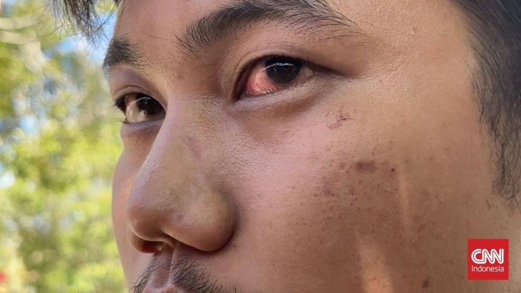 Insiden Jalan Raya, Direskrimum Polda Sumbar Diduga Aniaya Pengendara