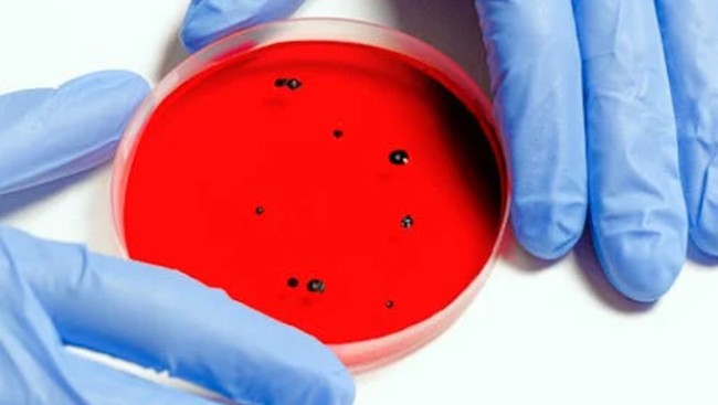 Geger! Virus dari Hewan Ternak di Eropa Kini Menginfeksi Manusia – Publik Pos Update